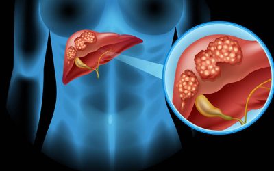 Who is the Best liver cancer treatment in Mumbai And Can be Easily Contacted in the Hospital?