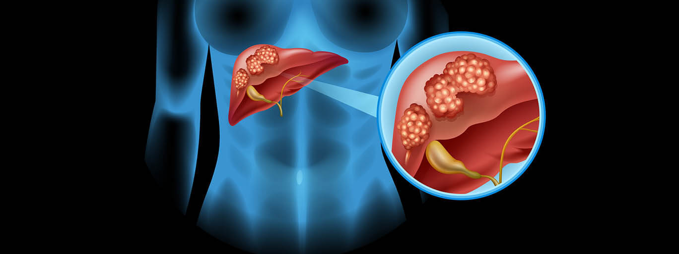 best doctor for liver cancer-in-mumbai