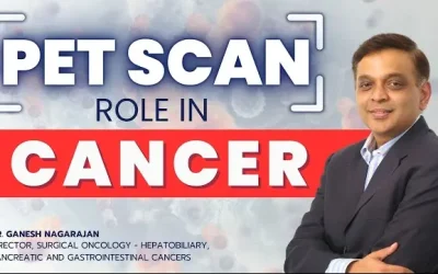 2024 Does Every Cancer Require PET Scan? Cancer Diagnosis
