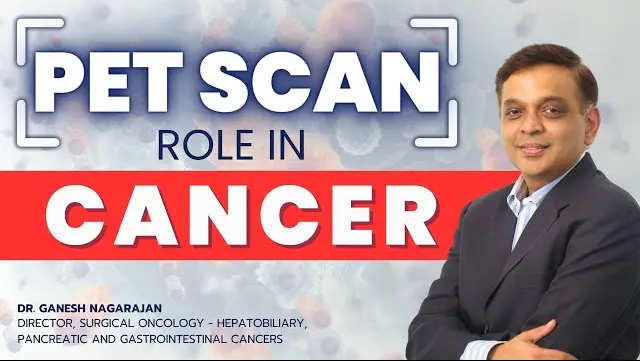 2024 Does Every Cancer Require PET Scan? Cancer Diagnosis
