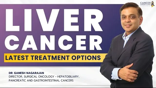 HCC Liver Cancer Treatments – Liver Resection
