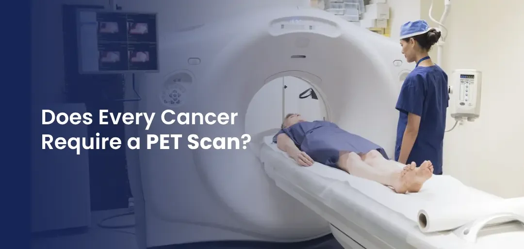 Does Every Cancer Require a PET Scan?