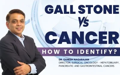 Are Your Gallstones Secretly Hiding a Cancer? 