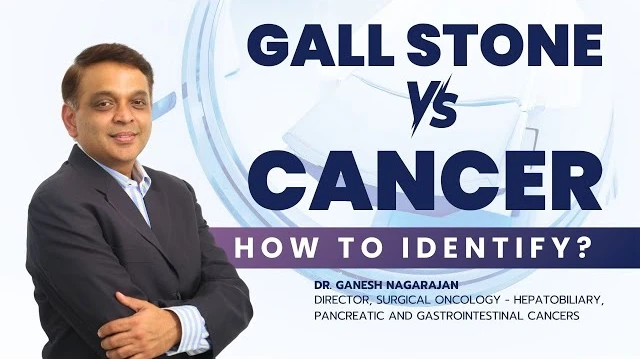 Are Your Gallstones Secretly Hiding a Cancer? 