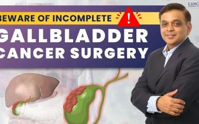 Understanding Gallbladder Cancer Surgeries | Dr. Ganesh Nagarajan Explains