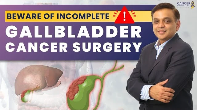 Understanding Gallbladder Cancer Surgeries | Dr. Ganesh Nagarajan Explains