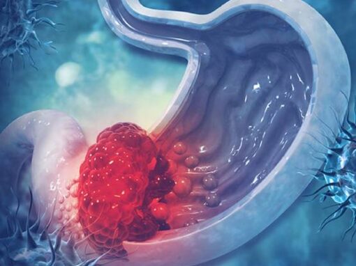 Gallbladder Cancer Surgery in Mumbai