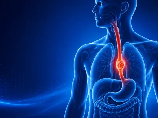 Esophageal Cancer Surgery in Mumbai